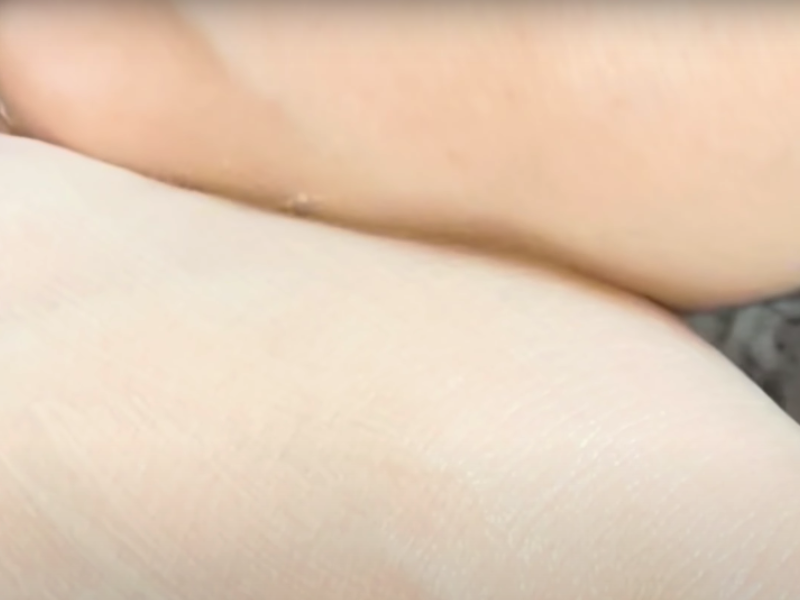 comparación de la base aplicada en una mano con la otra mano